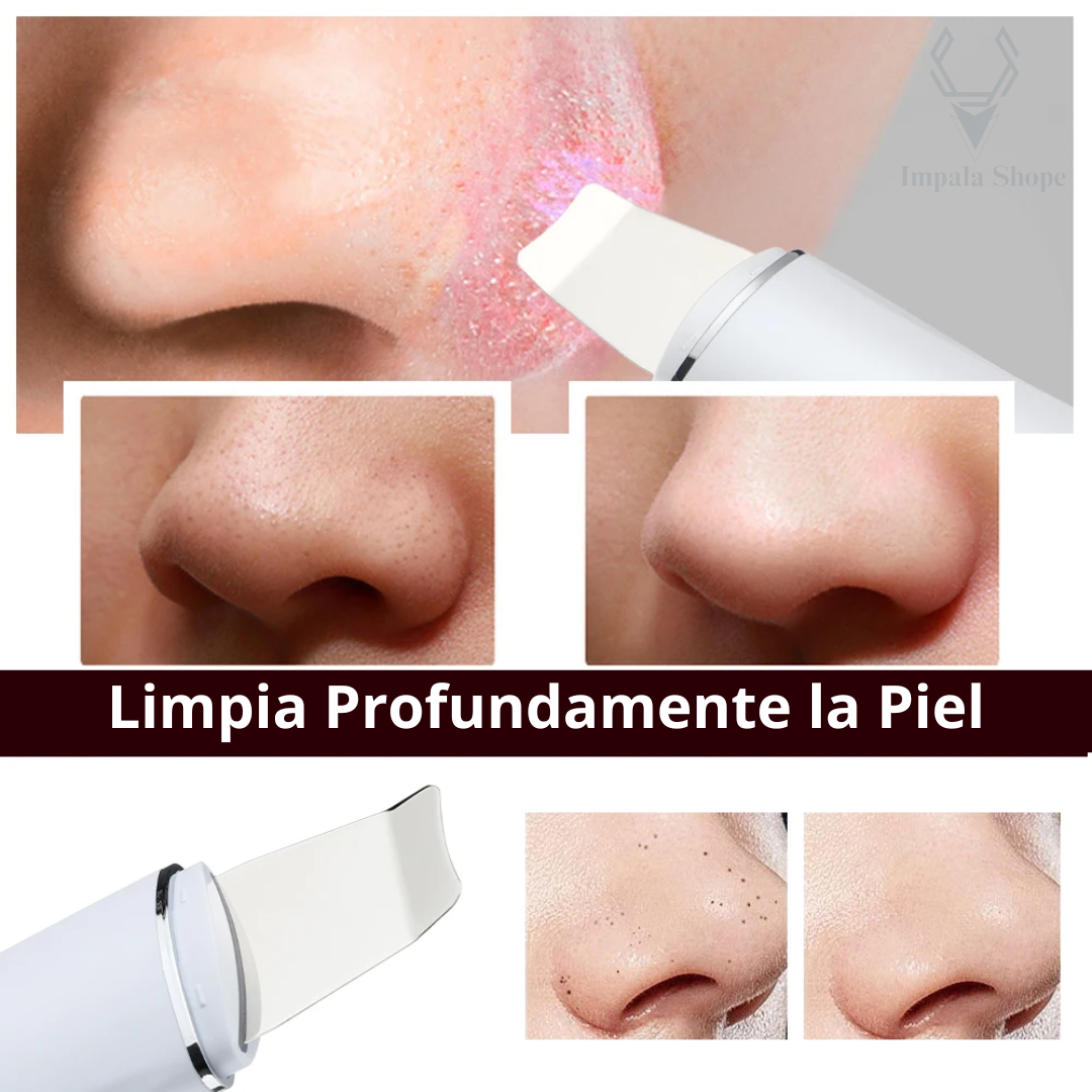 UltraGlow ™ Limpiador Peeling Facial Ultrasónico